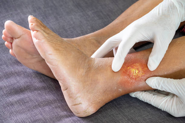 best doctor for gangrene treatment in navi mumbai
