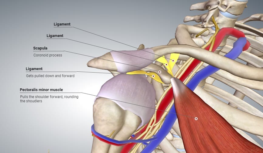 Thoracic Outlet Syndrome